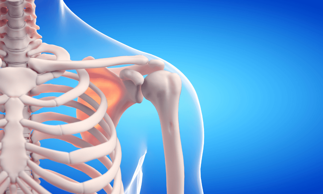 pathological fracture happens when a bone breaks