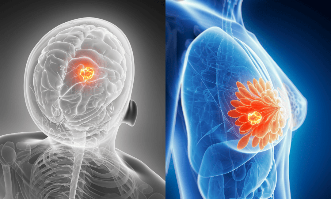 Persistent cough, abnormal bleeding, or changes in bowel habits, depending on location