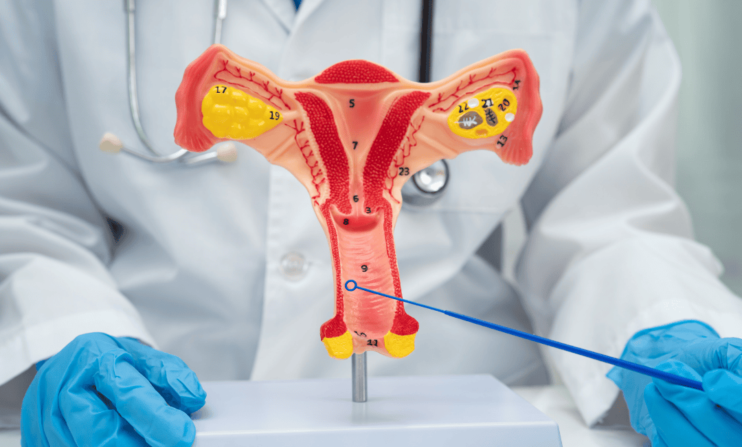 HPV and cervical cancer