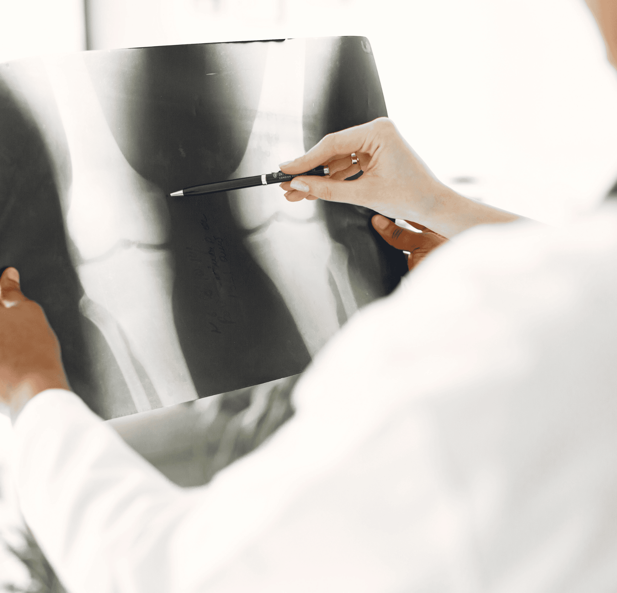 What Is Aplastic Anaemia? Symptoms, Cancer Link and Treatment image