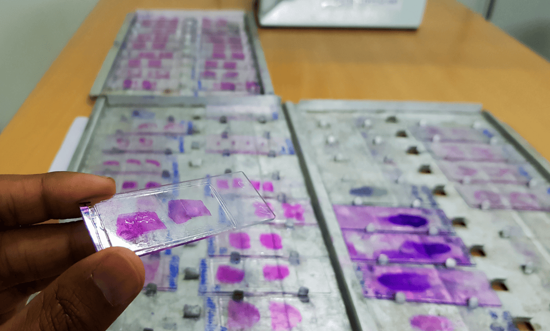Histopathology Test in Hindi (हिस्टोपैथोलॉजी टेस्ट): क्या होता है image