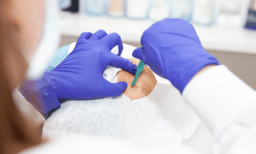 genetic testing through a blood or saliva sample