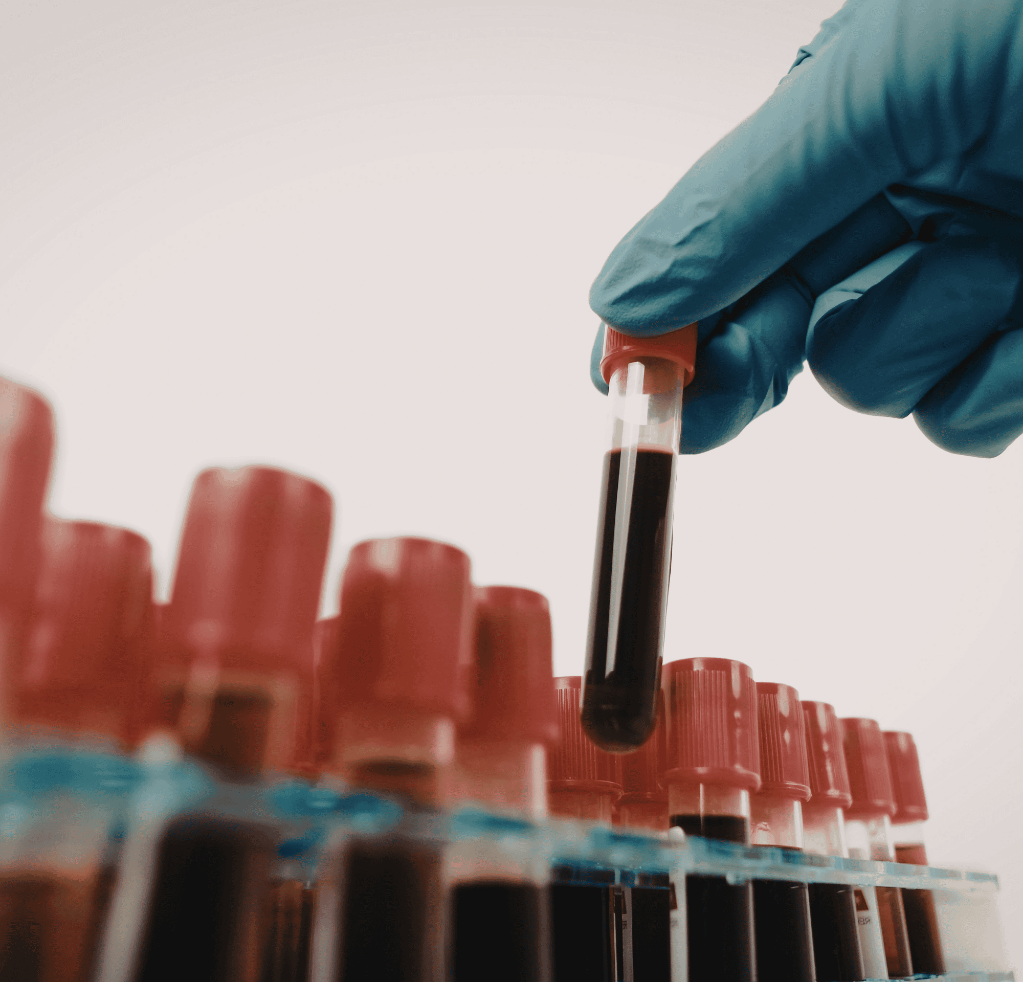 ESR Test for Cancer: What It Shows, Accuracy & Limitations