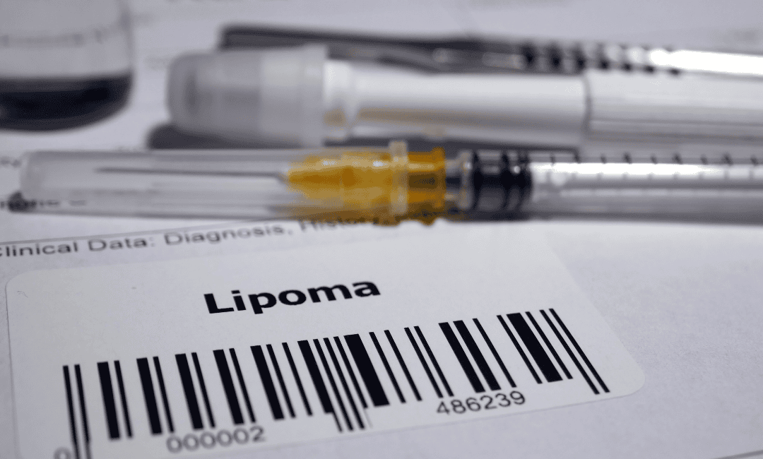 How is it diagnosed?
