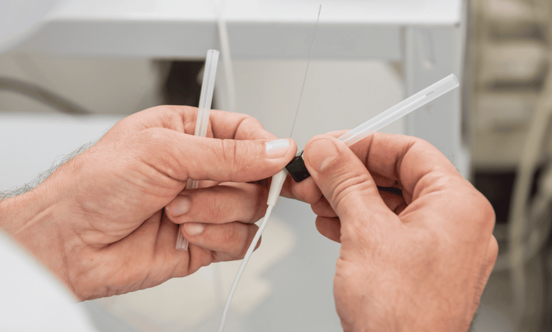 *What *Is *Cryoablation*? Procedure, Uses, and Benefits
 image
