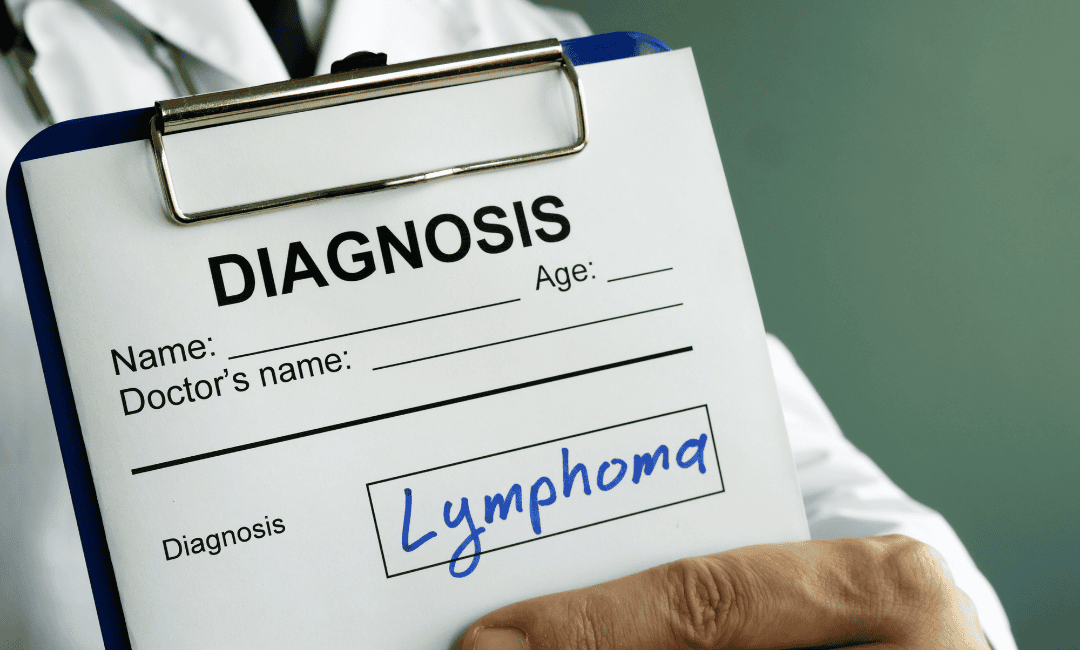 *What *Is *Burkitt *Lymphoma*? Symptoms, Causes, and Treatment
image