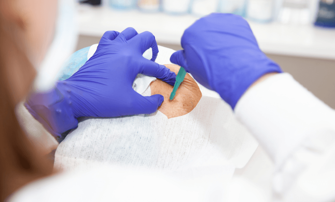 *What *Are *Tissue *NGS *and *Liquid *Biopsies *in *Lung *Cancer*? image