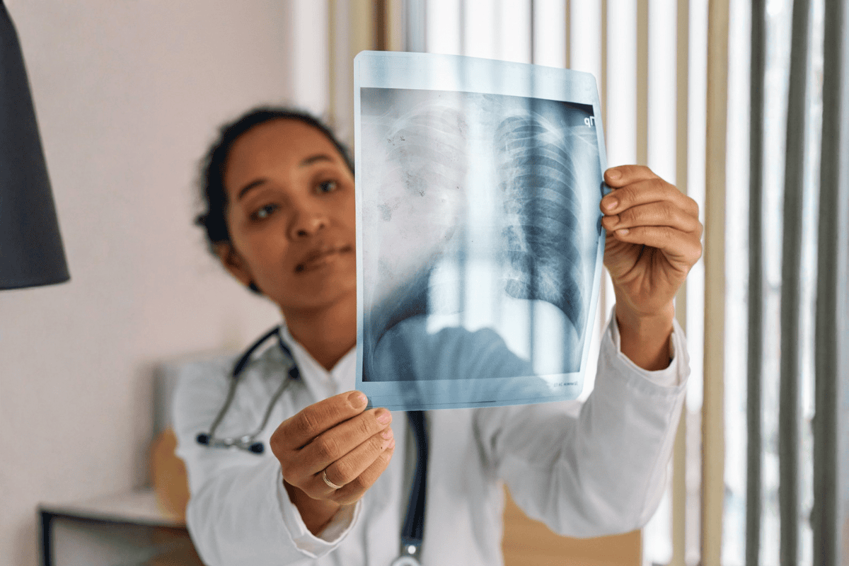 *Lung *Cancer *Detection: Can X-Ray Detect Lung Cancer Effectively image