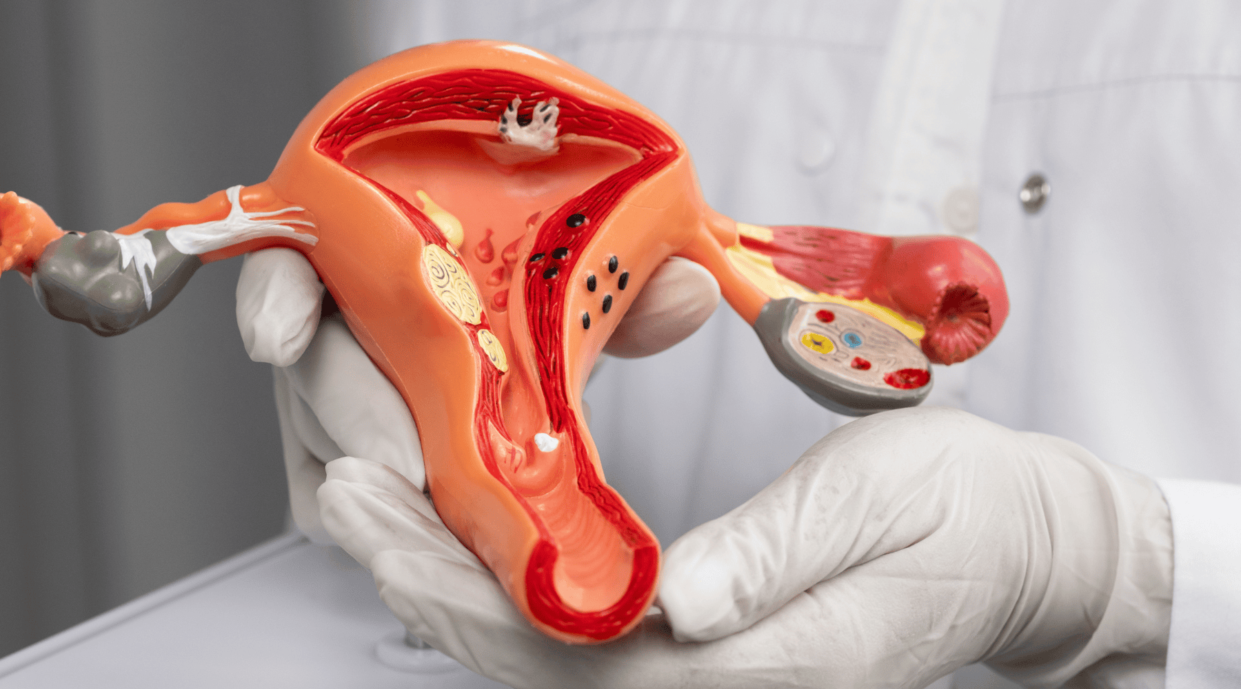 *Cervical *Cancer Symptoms in *Postmenopausal *Women image